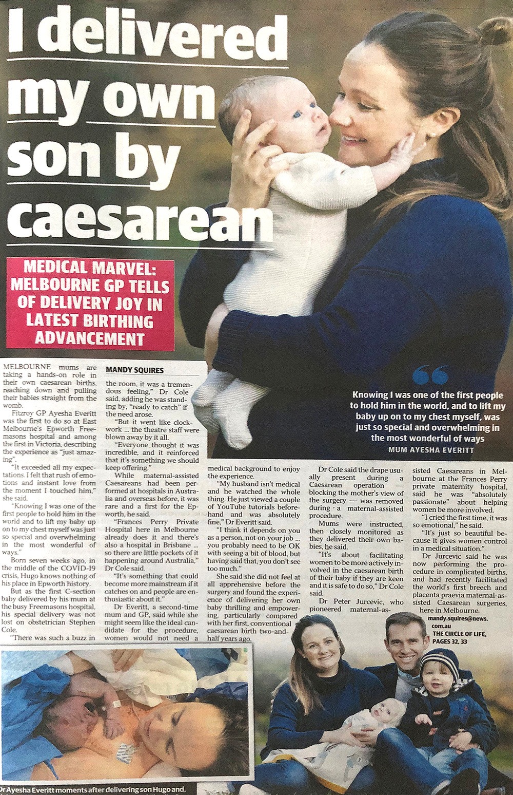 Maternal Assisted Caesarean Article