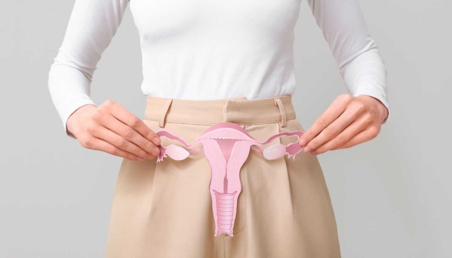 Polycystic Ovary Syndrome (PCOS)