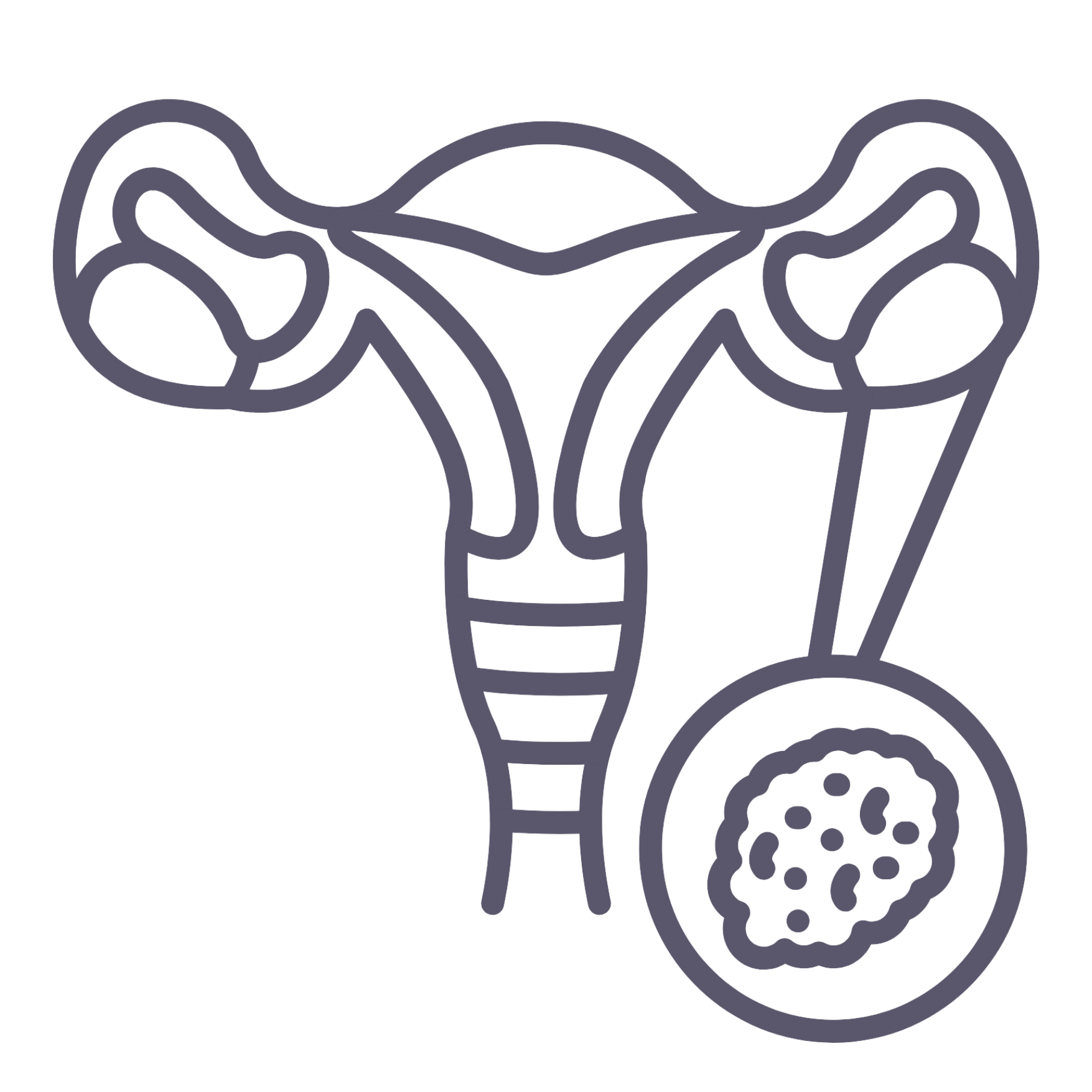Polycystic Ovary Syndrome PCOS